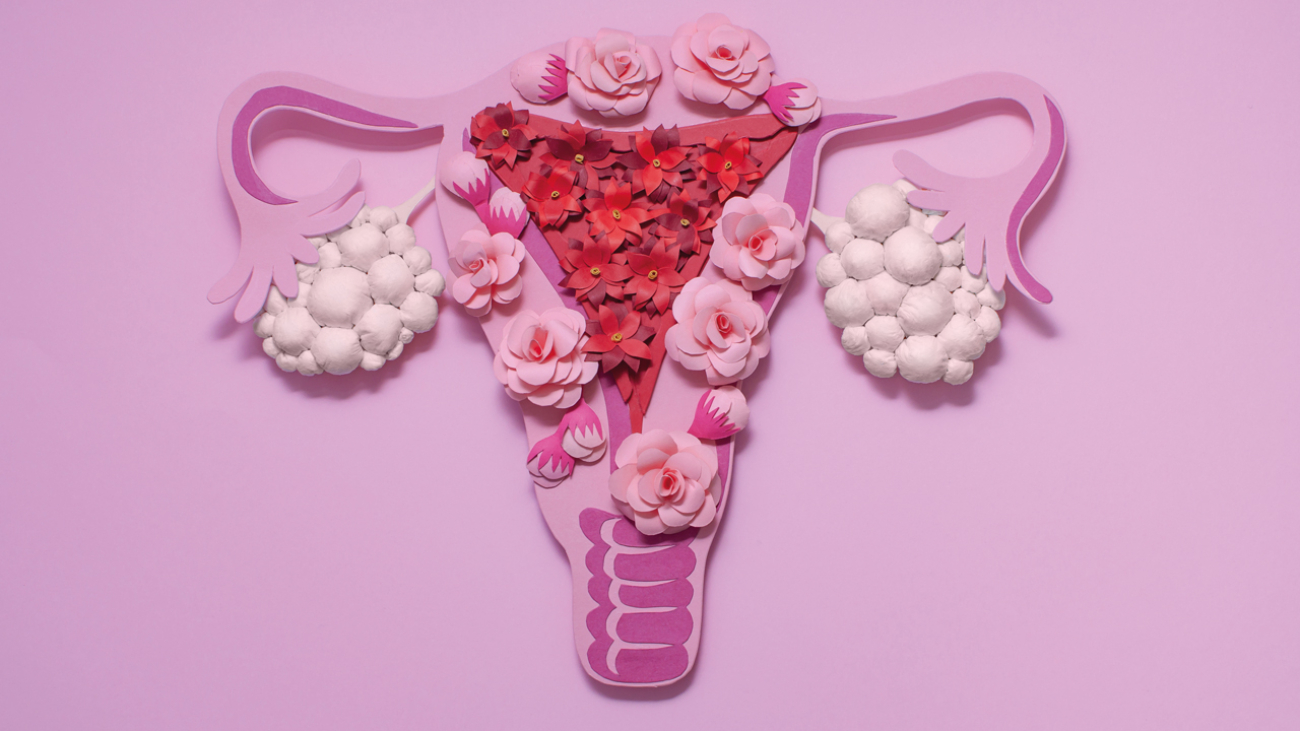 Polikistik Over Sendromu