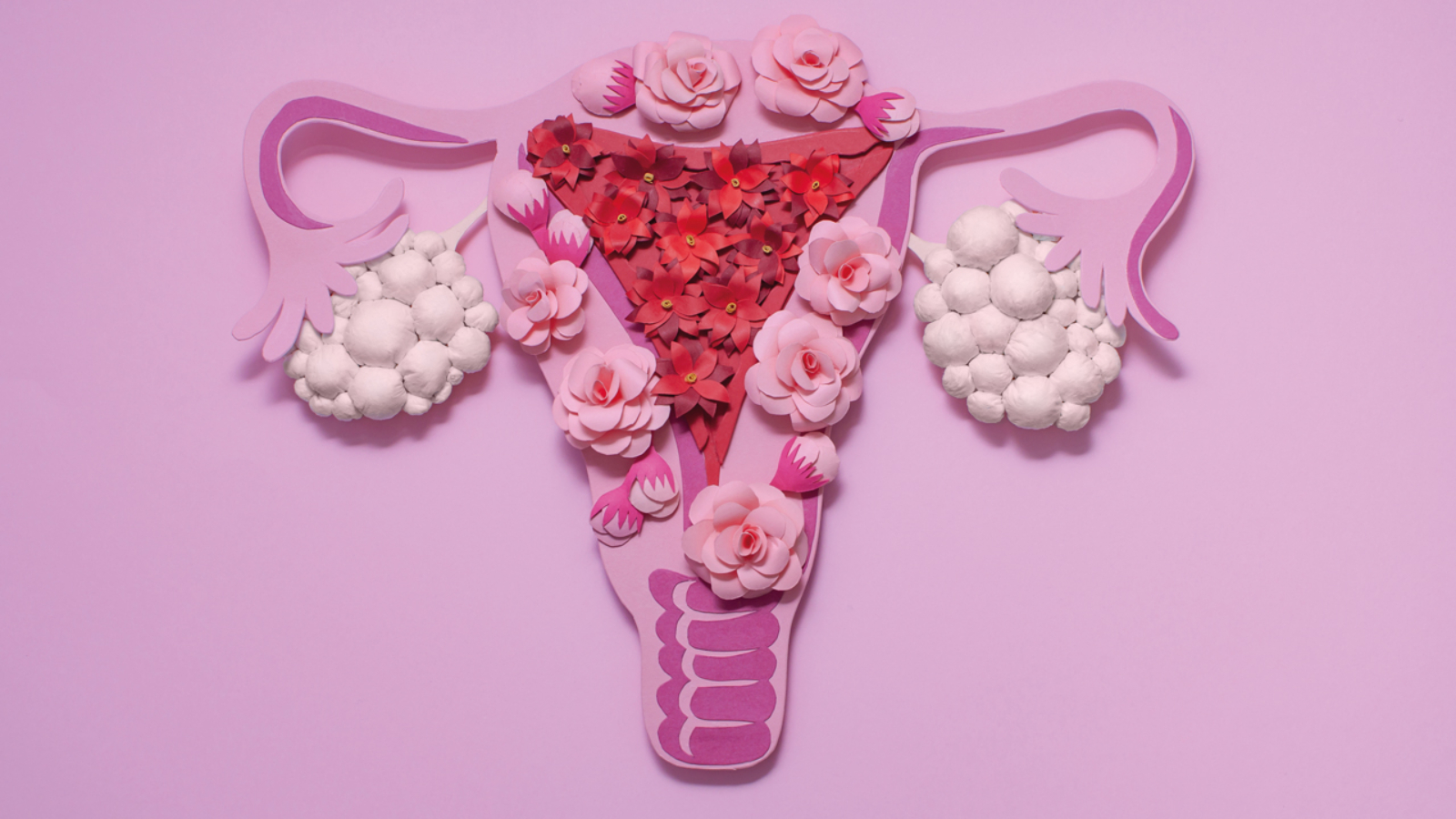 Polikistik Over Sendromu