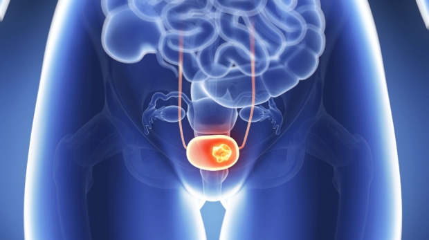 Rahim Ağzı Kanseri